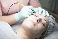 Electrolysis Hair Removal | Electrolysis in New York, NY